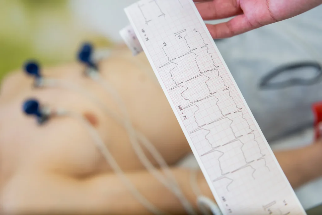 Eletrocardiograma (ECG) em Águas Claras